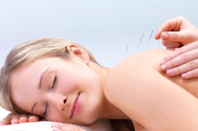 Some Tips About Acupuncture For You